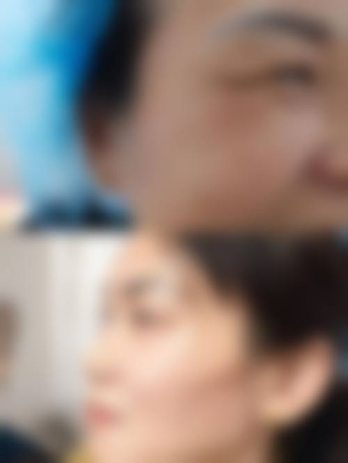苏州祛疤痕整形情况