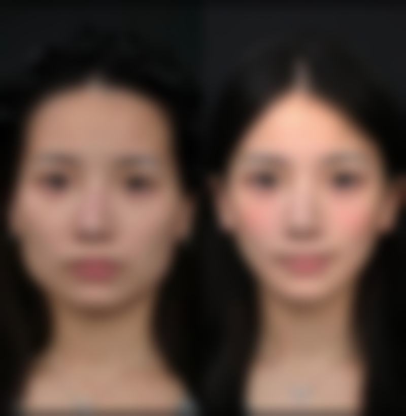 武汉新宛如星生整形医院怎么样项目特色