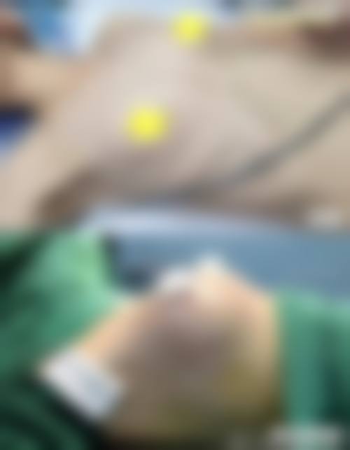 七、VN整形外科医院怎么样——口碑好不好?附真实患者口碑评价