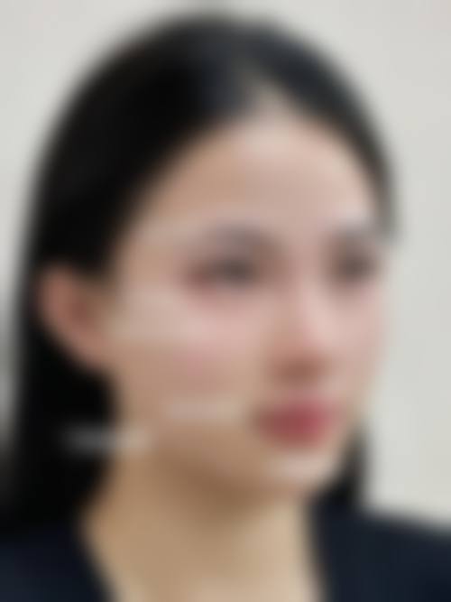 姜昌君医生项目优势