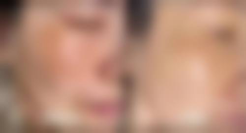 宁波米阳纯韩整形医疗美容医院项目特色