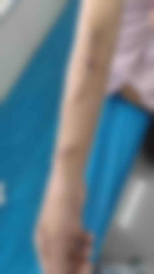 姜昌君医生做手术价格