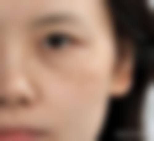 富美皮肤科怎么样,口碑好不好