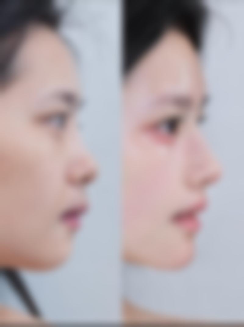 宁波米阳纯韩整形医疗美容医院价格表