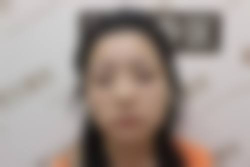 菏泽郓城县人民医院整形科口碑好不好?附真实患者口碑评价