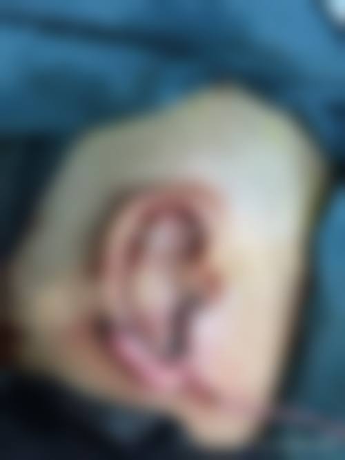 章德凤医生简介口碑如何