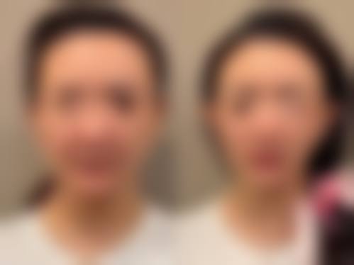 曹永茂医生简介项目优势