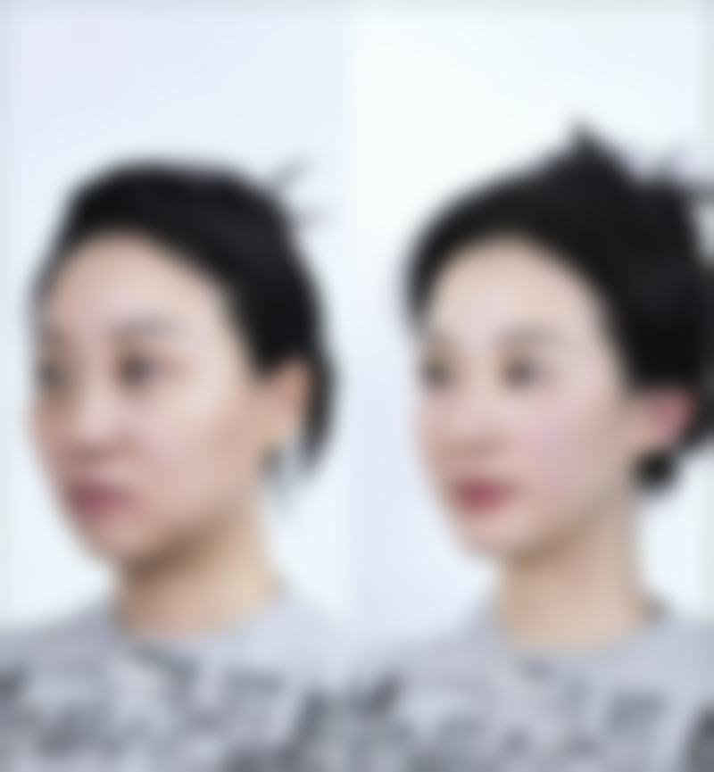 郝冬医生顾客实例图片