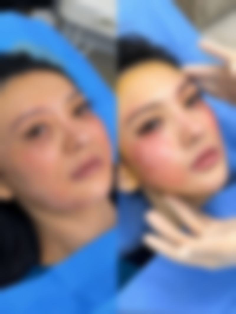 杭州悦可医疗美容诊所高寿松技术怎么样——杭州时光医疗美容医院