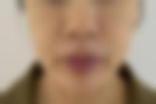 陕西咸阳星姿艾枚栗医疗美容资质
