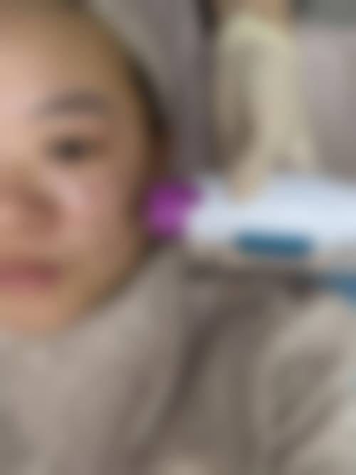 许昌市韦婷收费一览表——南京华美美容医院