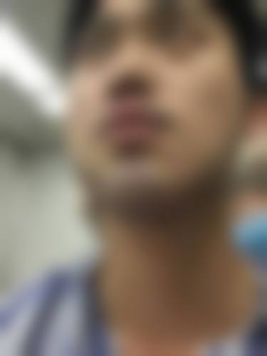 南漳县美辰整形医院价格表