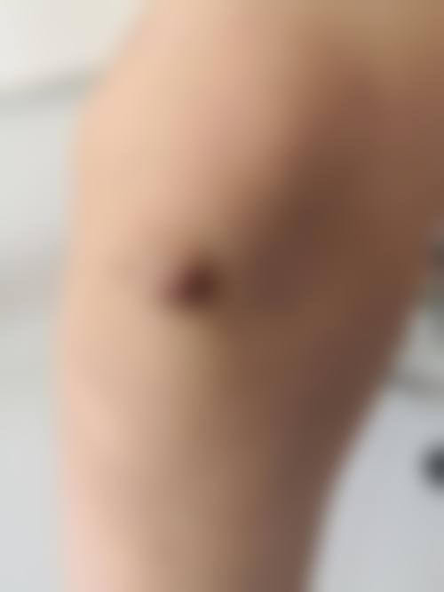 南漳县美辰整形医院项目特色