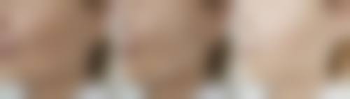 许昌市韦婷收费一览表——南京连天美美容医院