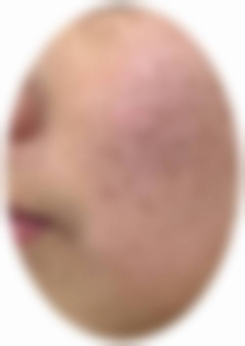 柴宇医生口碑如何