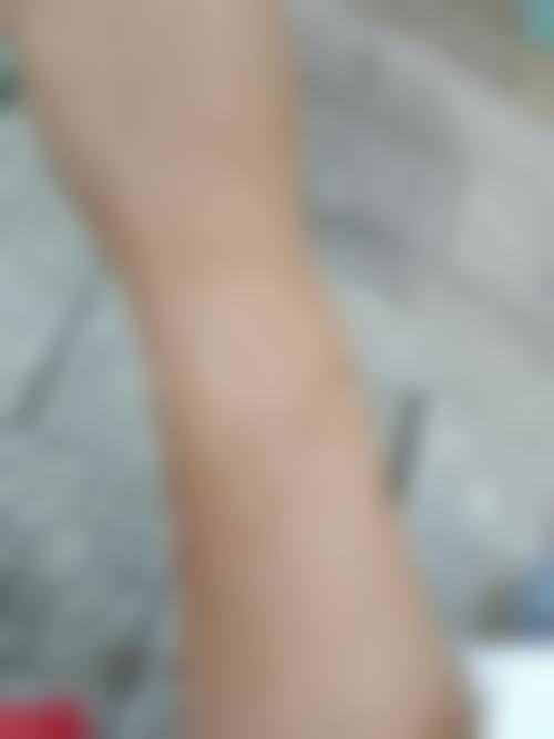 七、株洲华美整形美容医院口碑好不好?附真实患者口碑评价