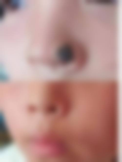 田霞医生项目优势