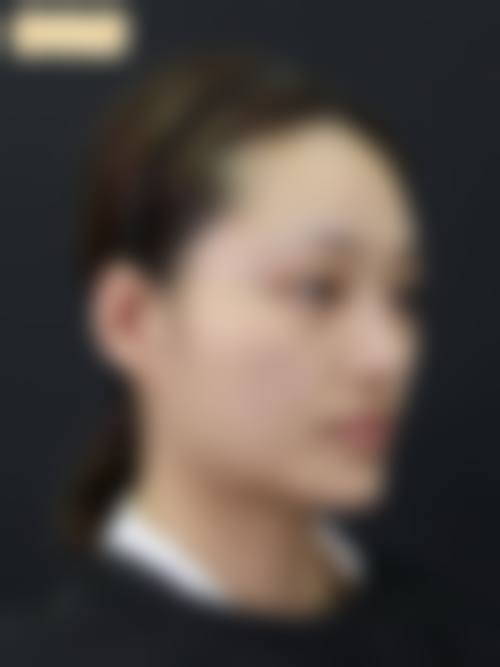 钟国良医生做手术价格
