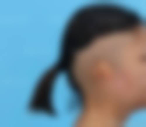 杨炳忠医生做手术价格