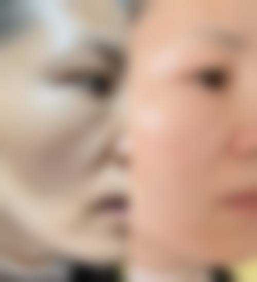 武汉斯启诺医疗美容门诊部Fotona 4D与埋线提升项目