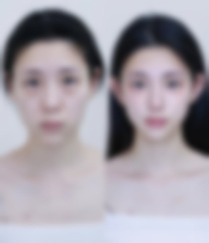 宁波尚美整形美容医院孙志强医生做手术价格