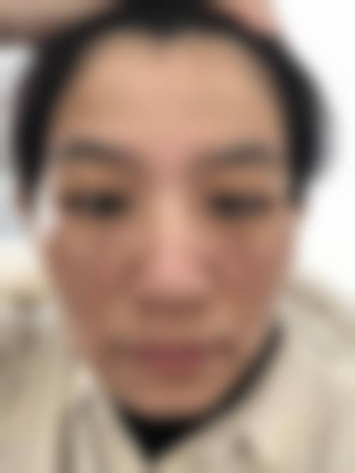 李允锡医生顾客实例图片