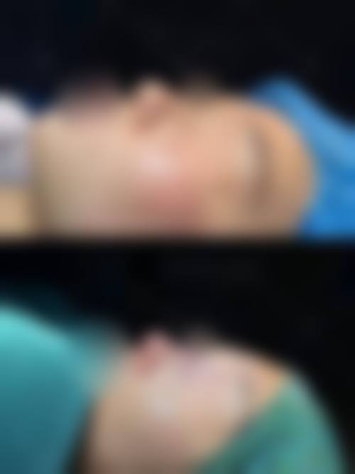 伊宁医生简介做手术价格