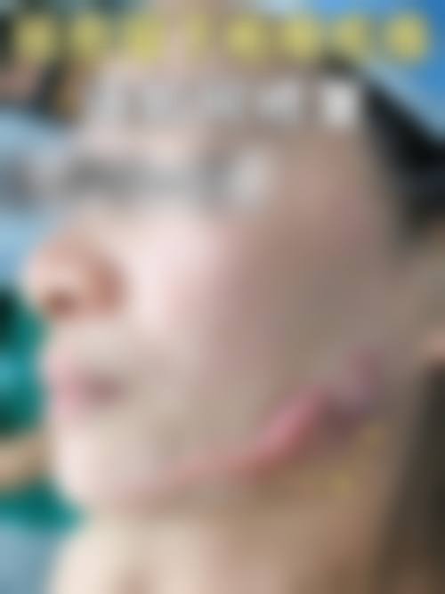 吴双医生口碑如何