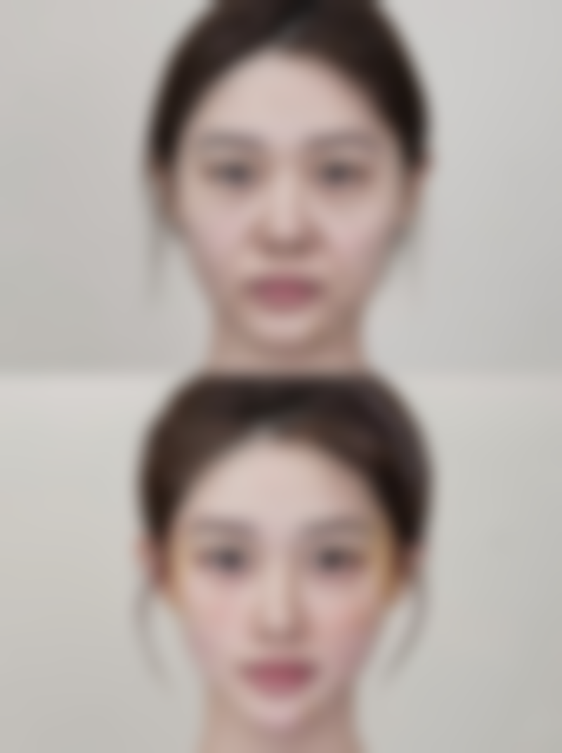 焦作雅典娜美容诊所价格表