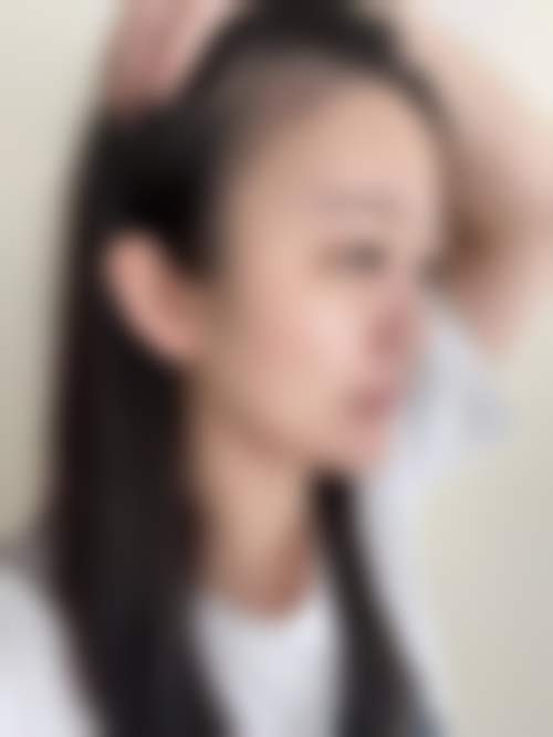 3000元嗨体1.5ml焕颜祛纹项目预约方式