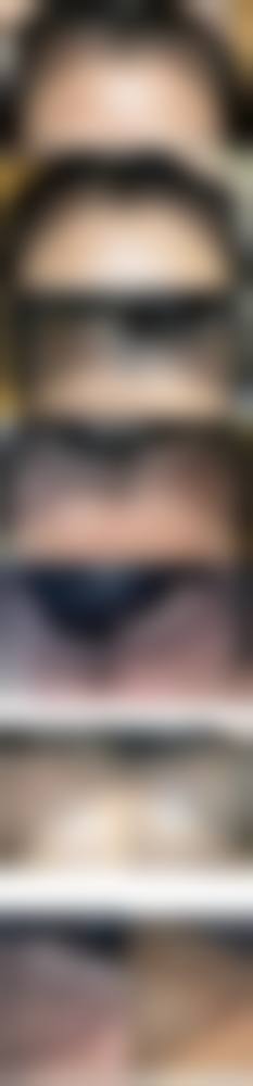 昆明圣丽童话医疗美容门诊部的顾客实例