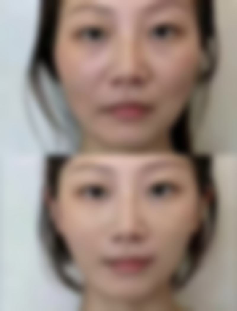 李东妮医生项目优势