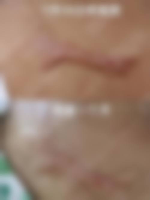 卢昊医生简介做手术价格
