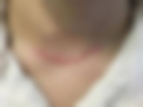 日南美容皮肤科口碑好不好