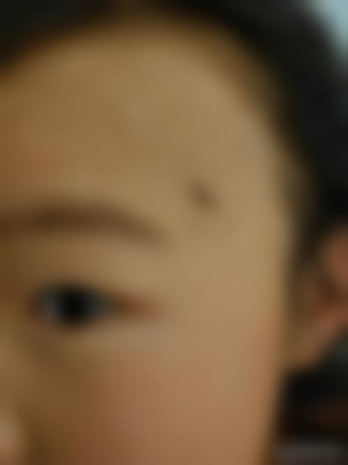 韩国德莱茵整形外科医院怎么样之价格表