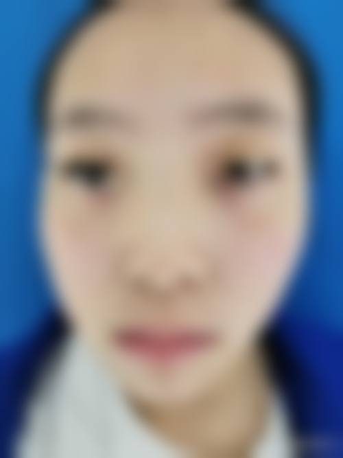 重庆好美新妍医疗美容门诊部顾客实例