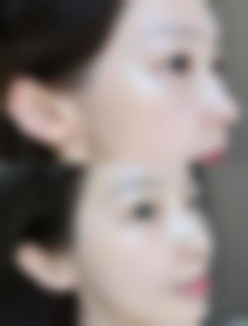 东阳璞奢佳妤整形医院怎么样,口碑评价如何?