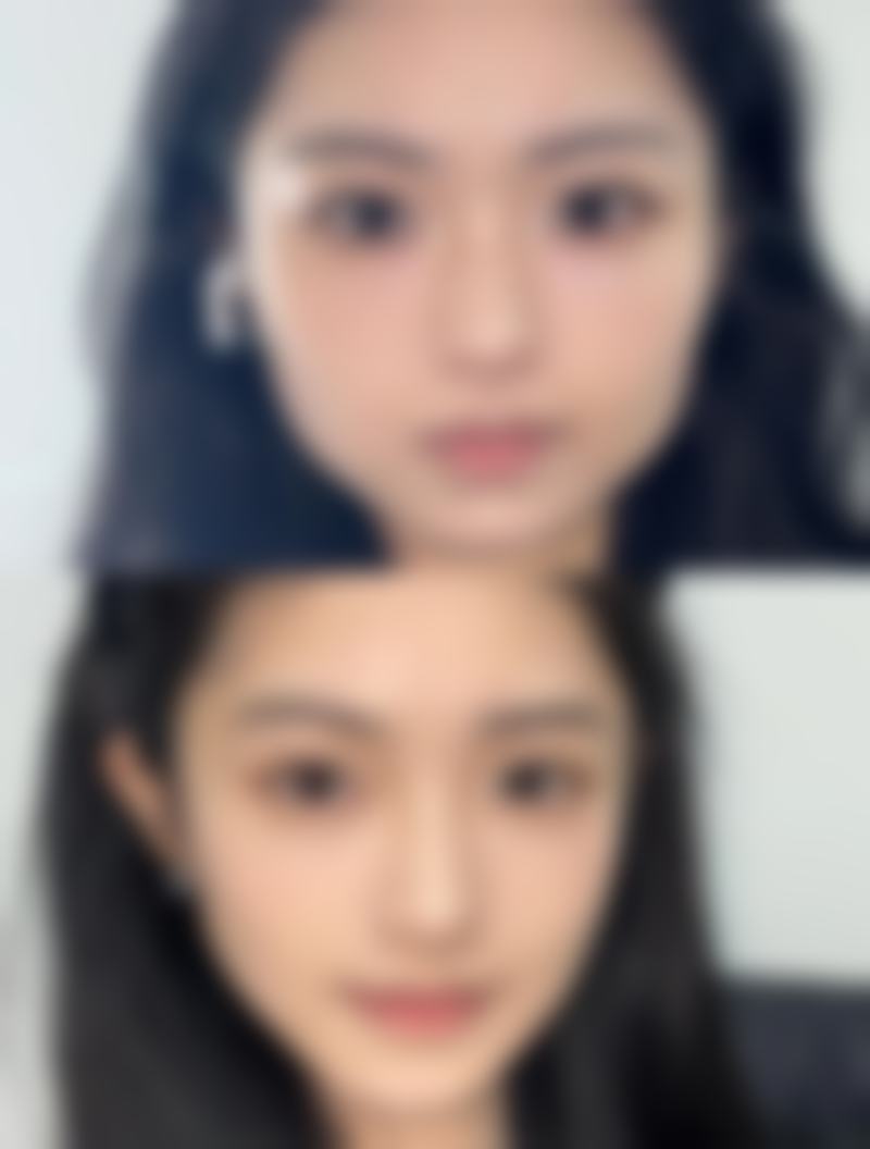 巴中悦莱美医疗美容门诊部更擅长什么