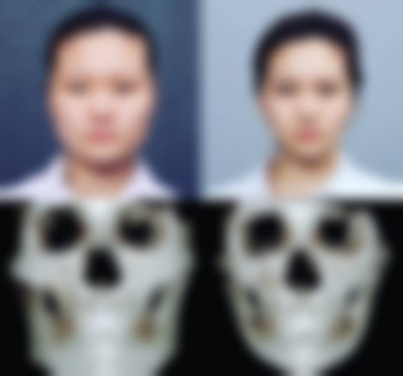东阳璞奢佳妤整形医院项目特色