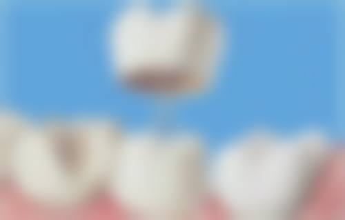 杭州贝佳康健康管理有限公司临平贝佳康口腔门诊部治疗反馈与口碑评价。