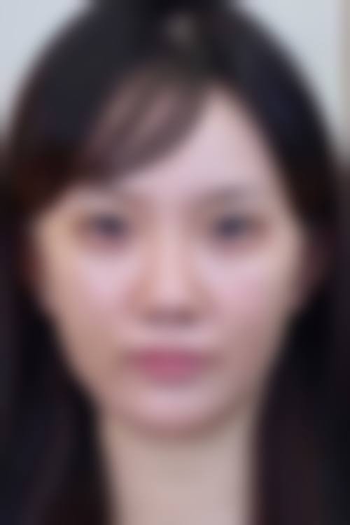 七、芜湖兰华整形医院口碑好不好?附真实患者口碑评价