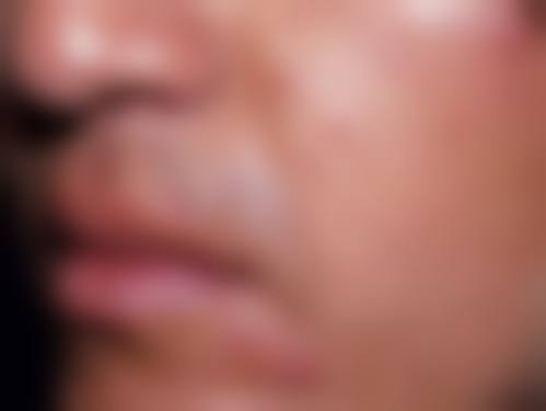 何成君医生简介做手术价格