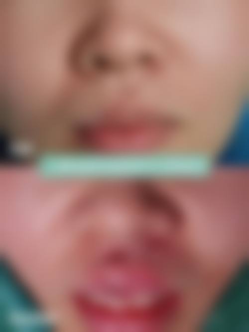 郑州羽中医疗美容诊所怎么挂号，地址在哪儿