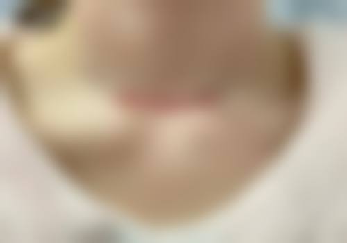 韩国MOSAIC整形外科口碑情况