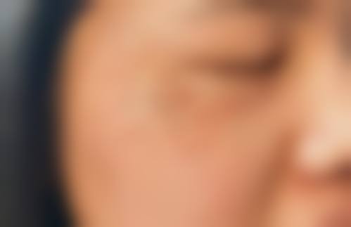 南通南洋整形医院怎么样价格表