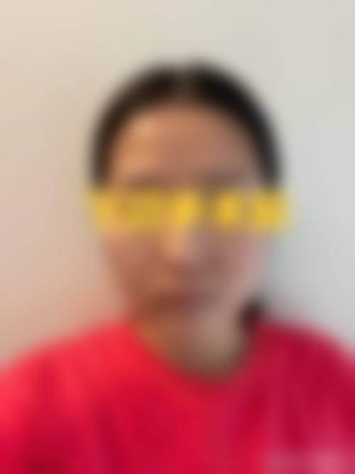 石家庄冀美医疗美容医院擅长项目解读