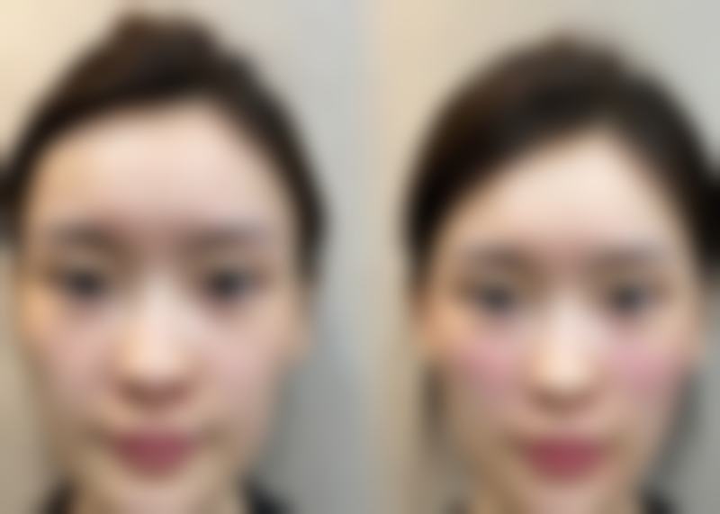 景德镇伊莱美整形医院项目特色