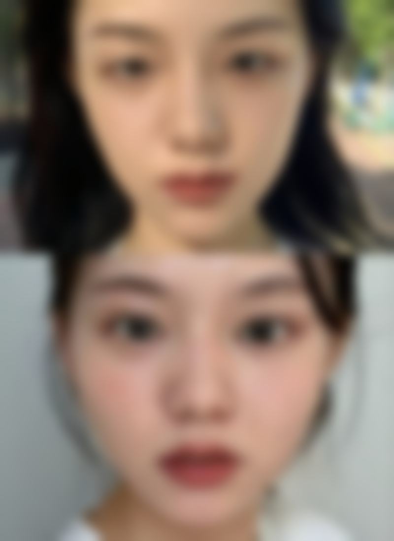 烟台英男医疗美容诊所价格表