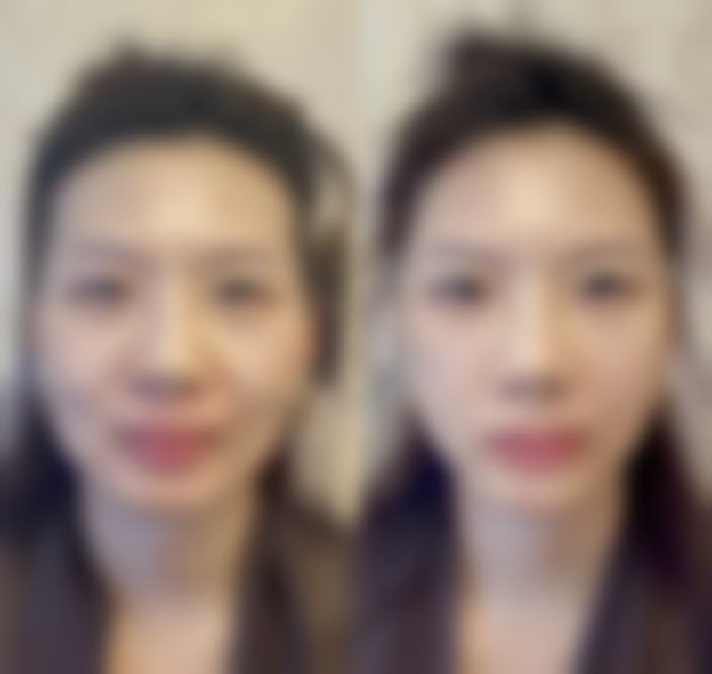 郑州羽中医疗美容诊所更擅长什么手术
