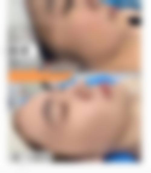 温州恩喜整形外科门诊部擅长项目。